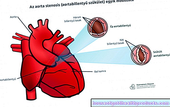 anatómia - aorta