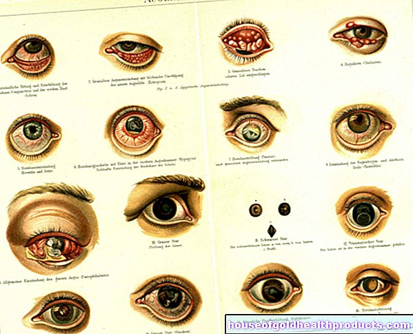 les yeux - Maladies des yeux