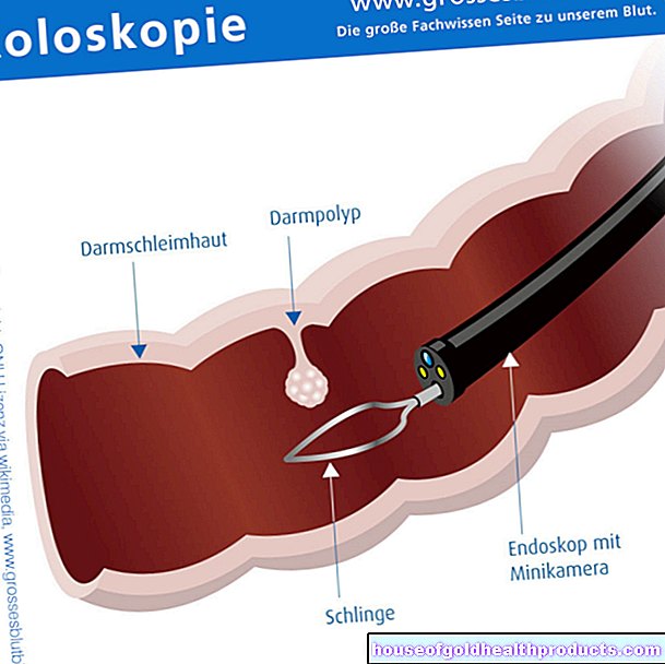 Colonoscopie: procedure