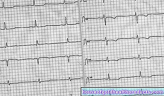 EKG: evaluering