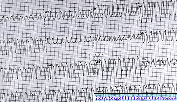 Diagnózis - EKG