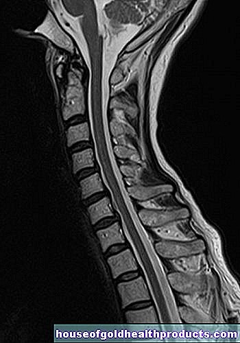 MRI：頸椎
