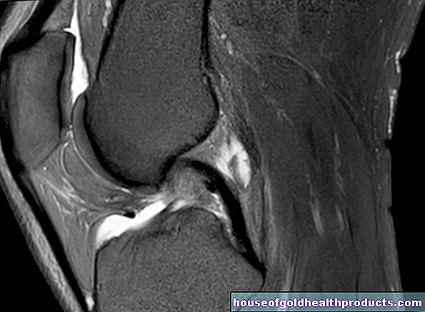 MRI：膝
