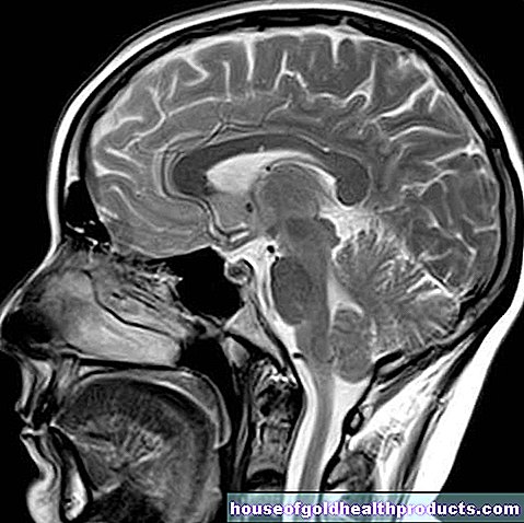 MRI: หัว