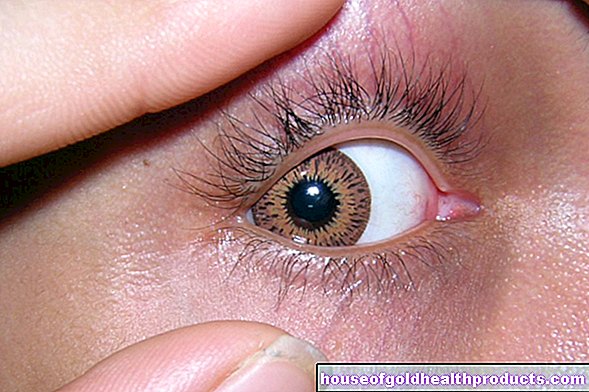 الإسعافات الأولية - مادة غريبة في العين