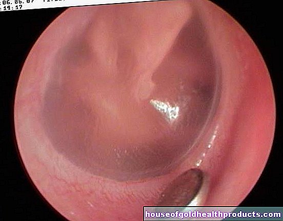 応急処置 - 耳の中の異物