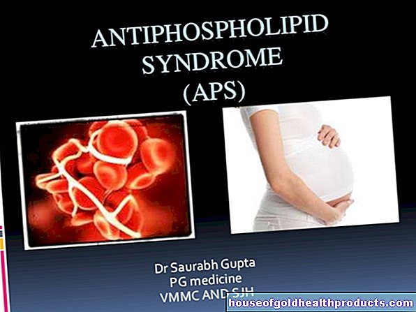Antifosfolipiidide sündroom (APS)