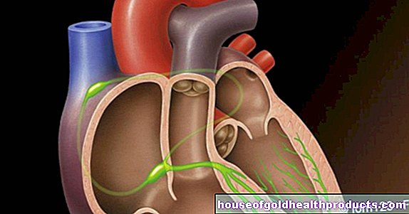 Zwężenie aorty