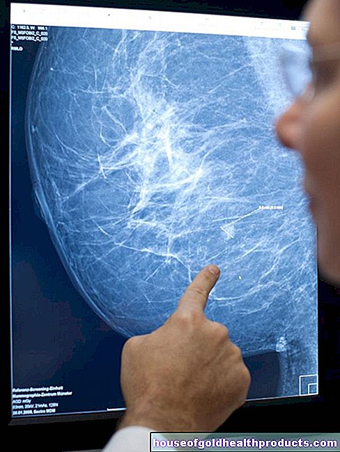 سرطان الثدي - فرص الشفاء