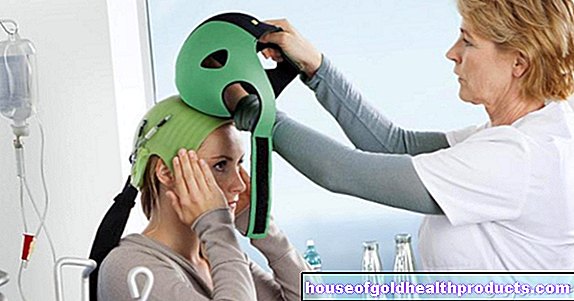 Chemoterapija: šalta galva apsaugo nuo plaukų slinkimo