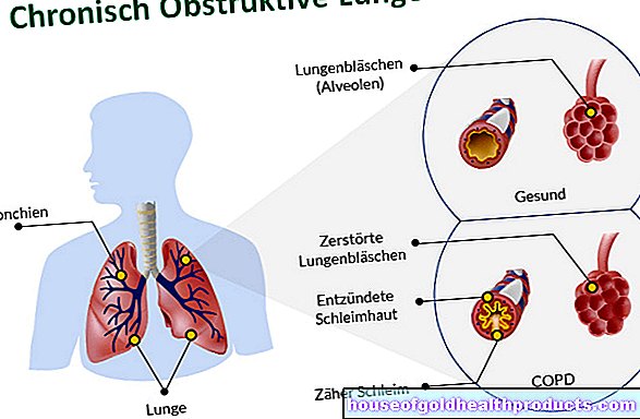 ХОББ: Коремната мазнина уврежда белите дробове