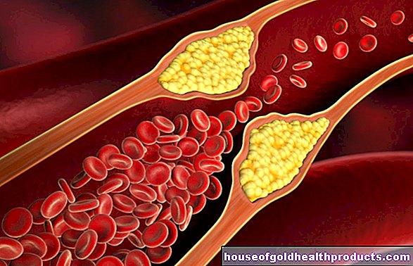 Batteri intestinali: sostanza vegetale contro l'arteriosclerosi