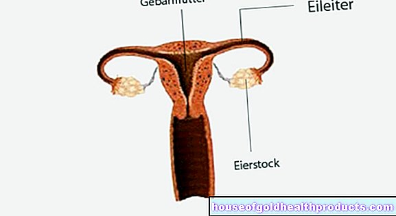 Inflammation of the fallopian tubes and ovaries