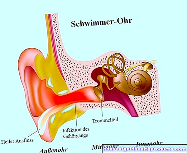 Inflamación del canal auditivo
