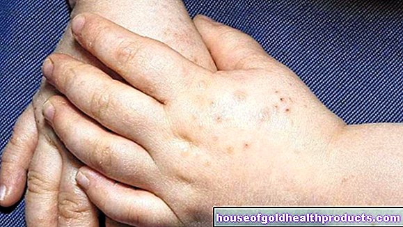 Malattia della mano, dell'afta epizootica