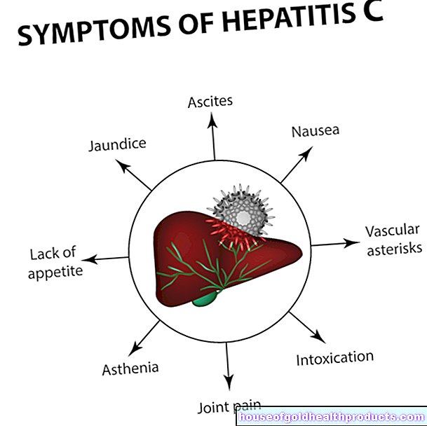 Hepatitis C.