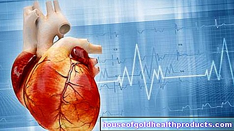 Serangan jantung: tes cepat memungkinkan terapi cepat