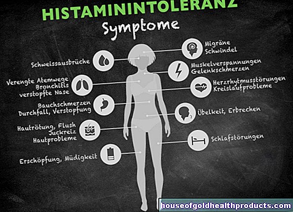 Непоносимост към хистамин