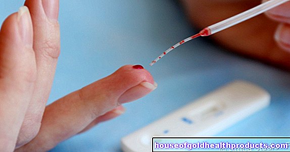 Ujian diri HIV: "semakin cepat semakin baik"