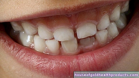 Кредови зъби