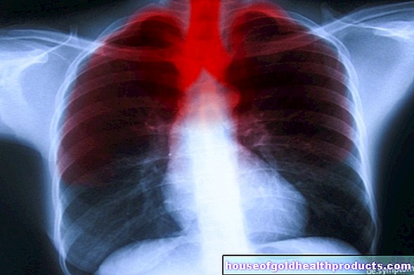 Инфекция на белите дробове