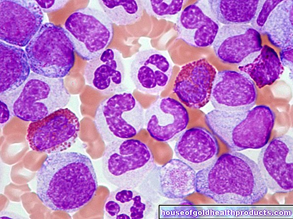 Myeloïde leukemie