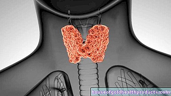 Щитовидна жлеза: Доброкачествените възли се проверяват твърде често