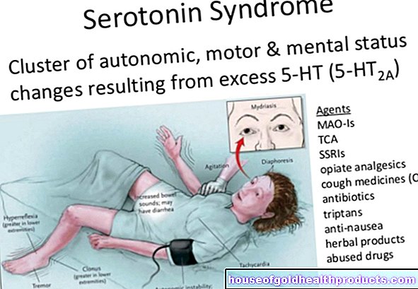 Серотонинов синдром