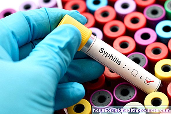 syfilis