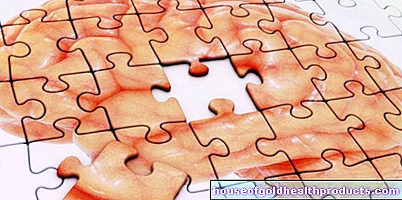 Rozdiel medzi Alzheimerovou chorobou a demenciou