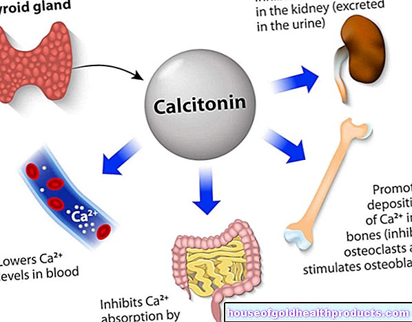 Kalcitonín