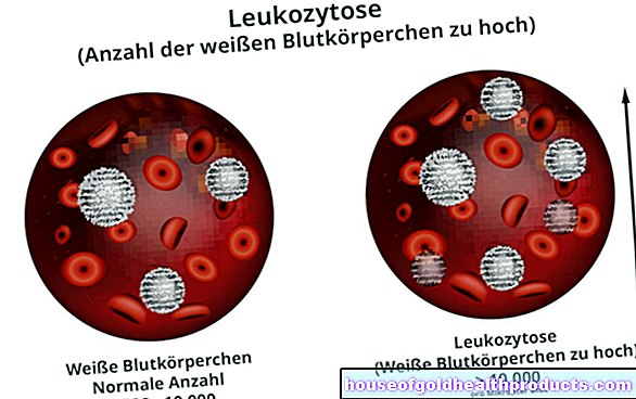 Leukocytóza