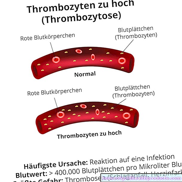 Trombocytóza