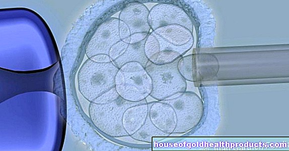 Kmeňové bunky - časté otázky