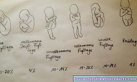 el embarazo - Posición de nalgas