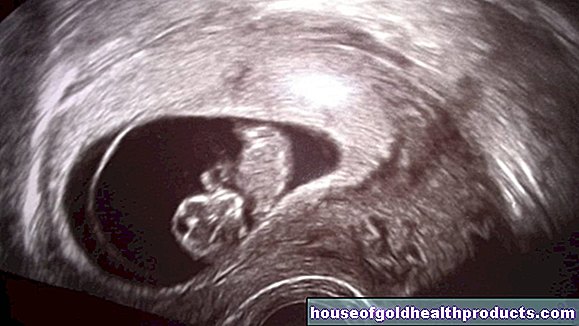 Första trimester screening