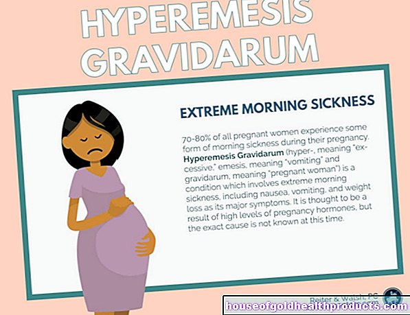 Гиперемезис беременных
