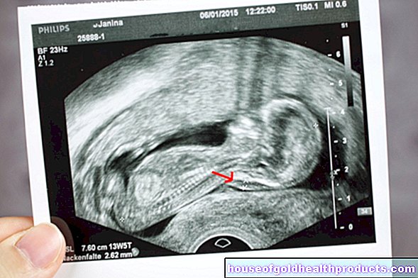 těhotenský porod - Měření záhybu na krku
