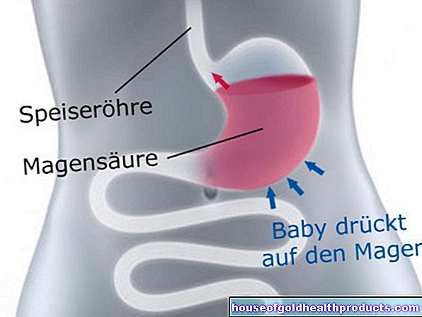 embarazo nacimiento - Acidez de estómago durante el embarazo