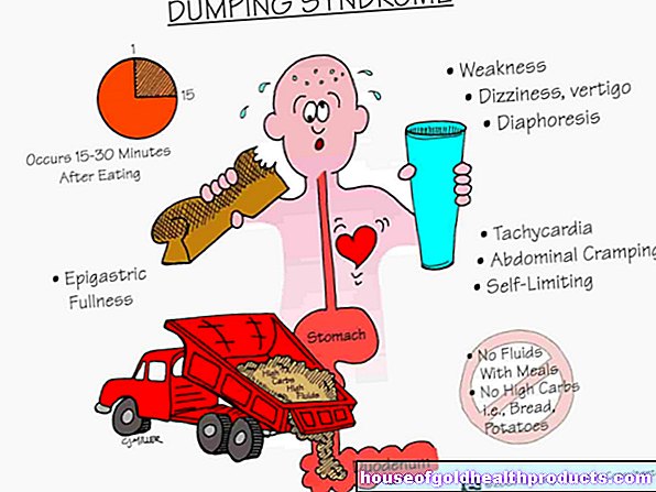 Dumping syndrome