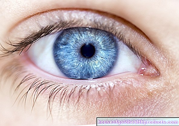 simptomai - Patinusios akys
