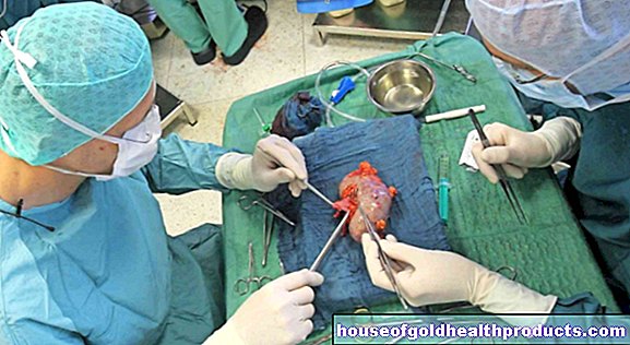 Transplant de rinichi