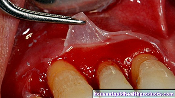 hambad - Suu limaskest - olulised haigused