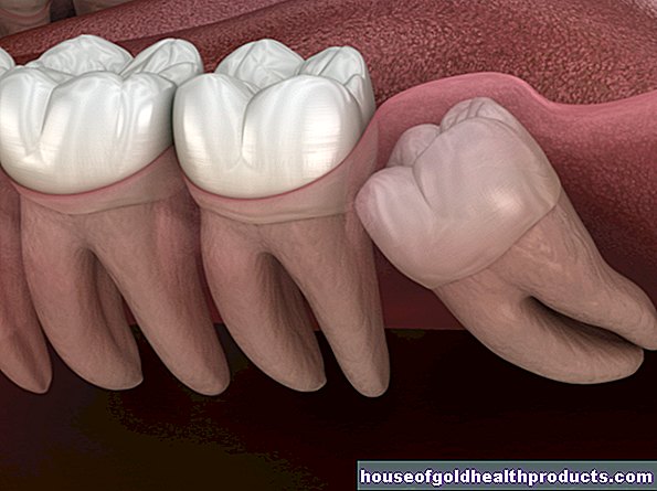dientes - Muelas del juicio