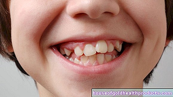 zuby - Nesrovnané zuby a čelisti